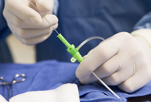 Cateterismo Cardíaco